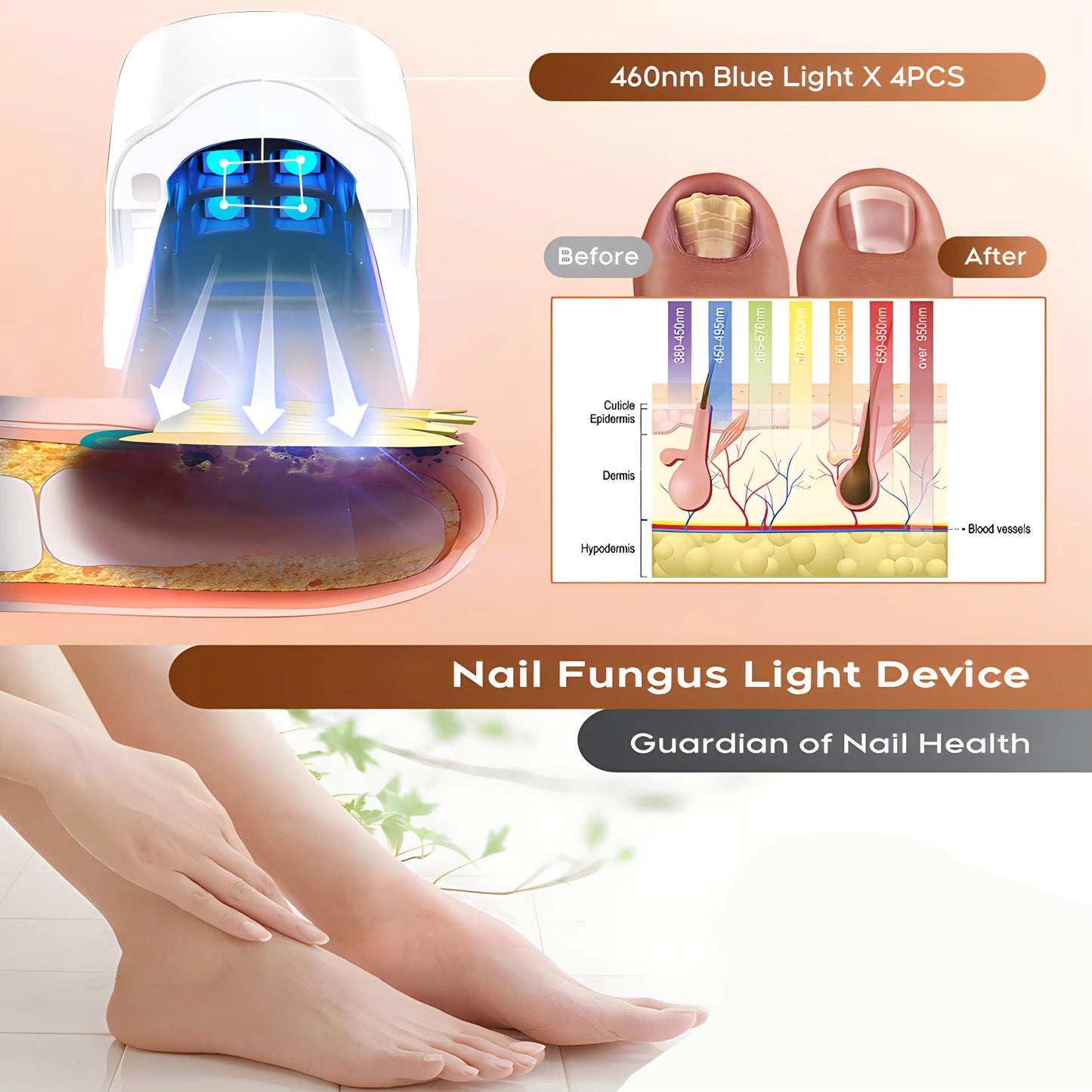 Appareil de thérapie laser pour ongles KTS 910nm/407nm – Anti-Mycose Puissant, Portable & Rechargeable